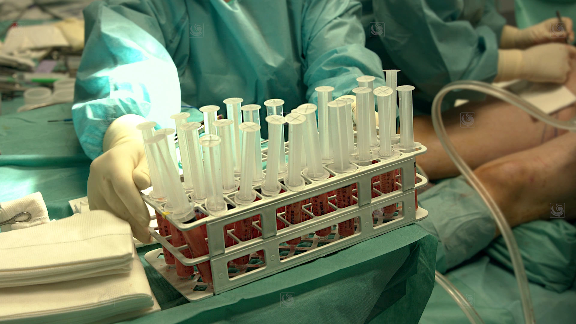 Fotograma de video mostrando detalles de diverso instrumental quirúrjico